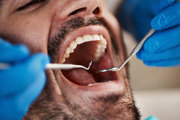 Best Urgent Care for Lost Fillings or Crowns in Bay St Louis, MS